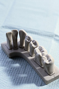 Dental Oral fillings