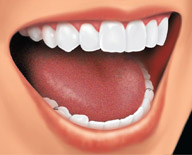 Partial Denture Bottom