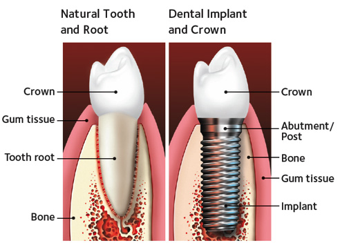 Tooth Place